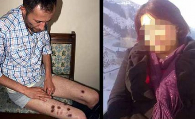 Diyarbakır'da ilginç olay: Kocasının üzerinde sigara söndürdü!
