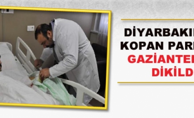 Diyarbakır'da Kopan Parmağı Gaziantep'te Dikildi